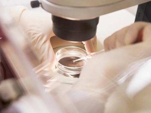Microiniezione di uno spermatozoo in un ovocita durante una tecnica di fecondazione assistita