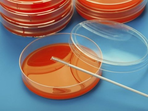 Piastre di coltura e tampone per il test del Papilloma Virus
